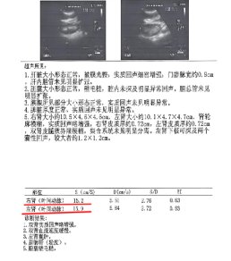 JEAN夫妇为王院长、李主任赠予锦旗